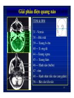Bài giảng : Giải phẫu thần kinh đối chiếu chẩn đoán Hình ảnh part 5 ppsx