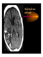 bài giảng : CT Scan trong tai biến mạch máu não part 3 pps