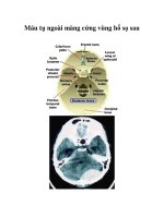 Máu tụ ngoài màng cứng vùng hố sọ sau doc