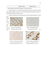 Luận văn : ỨNG DỤNG PHƯƠNG PHÁP IN SITU HYBRIDIZATION ĐỂ CHẨN ĐOÁN MẦM BỆNH WSSV (White Spot Syndrome Virus) TRÊN TÔM SÚ (Penaeus monodon) VÀ TSV (Taura Syndrome Virus) TRÊN TÔM THẺ CHÂN TRẮNG (Penaeus vannamei) part 3 doc