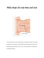 Phẫu thuật cắt ruột thừa (mổ mở) docx