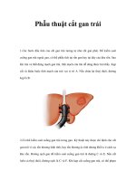 Phẫu thuật cắt gan trái pot