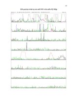 Luận văn : SỬ DỤNG KỸ THUẬT DAS-ELISA VÀ RT-PCR ĐỂ PHÁT HIỆN VIRUS GÂY BỆNH ĐỐM VÕNG TRÊN CÂY ĐU ĐỦ (Papaya ringspot virus) TẠI HAI TỈNH ĐỒNG NAI VÀ ĐỒNG THÁP part 9 ppsx