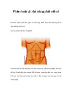Phẫu thuật cắt đại tràng phải nội soi ppt