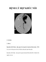 BỆNH LÝ HẸP KHÚC NỐI pps
