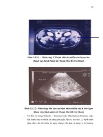 Luận văn : Thu thập dịch tiết từ Fasciola gigantica và sử dụng làm kháng nguyên trong chẩn đoán part 2 pptx
