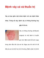 Bệnh vảy cá và thuốc trị doc