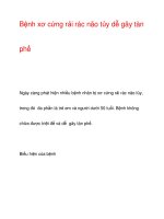 Bệnh xơ cứng rải rác não tủy dễ gây tàn phế ppsx