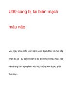 U30 cũng bị tai biến mạch máu não pps