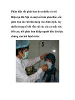 Phân biệt sốt phát ban do rubella và sởi ppsx
