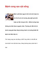 Bệnh cong vẹo cột sống ppt