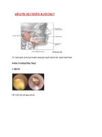 ĐIỀU TRỊ SỎI TUYẾN NƯỚC BỌT pot