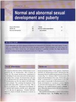 Normal and abnormal sexual development ppt