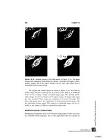 Biosignal and Biomedical Image Processing phần 10 pdf