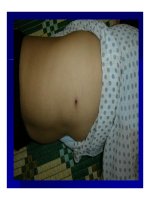 Bài giảng Các bệnh nhiễm rickettsiae (rickettsioses) part 4 pdf