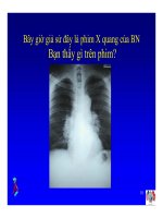Bài giảng điều trị H3IV : Các hội chứng hô hấp trong nhiễm HIV part pps