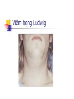 Bài giảng Viêm Họng part 5 docx