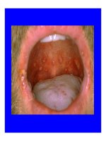 Bài giảng chẩn đoán và điều trị Viêm màng não part 7 ppt