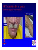 Bài giảng điều trị HIV : Thuốc kháng retrovirus - Liều dùng và tác dụng phụ part 3 potx