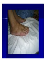 Bài giảng Các bệnh nhiễm rickettsiae (rickettsioses) part 6 ppsx