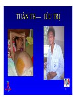 Bài giảng điều trị HIV : Tuân thủ điều trị part 7 pps