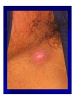 Bài giảng Các bệnh nhiễm rickettsiae (rickettsioses) part 5 potx