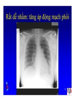 Bài giảng điều trị HIV : Các hội chứng hô hấp trong nhiễm HIV part 5 ppsx