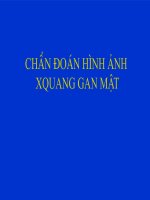 Tài liệu X QUANG  gan mật