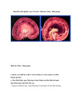 Sáng kiến kinh nghiệm y học cổ truyền – Bệnh học Thận – Bàng quang pps