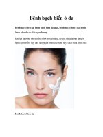 Bệnh bạch biến ở da docx