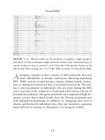 Handbook of EEG interpretation - part 2 pdf