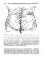 PRINCIPLES OF NEUROLOGY - PART 3 docx