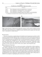 PATHOLOGY OF VASCULAR SKIN LESIONS - PART 2 pdf