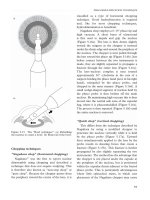 Fundamentals of Clinical Ophthalmology - part 4 pdf