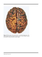 PARKINSON’S DISEASE AND RELATED DISORDERS - PART 7 pot