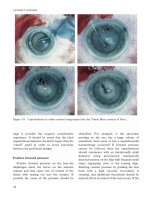 Fundamentals of Clinical Ophthalmology - part 3 ppt