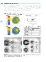 Cataract and Refractive Surgery - part 7 pptx
