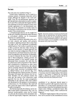 General ultrasound In the critically ill - part 9 pot