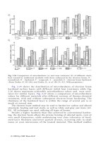 Surface Engineering of Metals - Principles, Equipment and Technologies Part 4 pptx