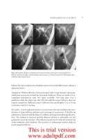 ADVANCED DIGESTIVE ENDOSCOPY: ERCP - PART 3 pptx