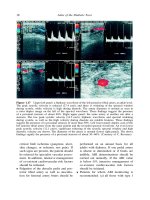 Atlas of the Diabetic Foot - part 2 ppsx