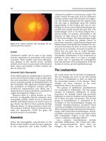 Common Eye Diseases and their Management - part 9 doc