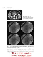 ADVANCED DIGESTIVE ENDOSCOPY: ERCP - PART 6 docx