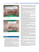 Wound Healing and Ulcers of the Skin - part 8 pdf