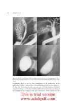 ADVANCED DIGESTIVE ENDOSCOPY: ERCP - PART 2 doc