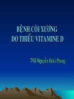 bệnh còi xương do thiếu vitamine D