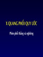 xquang phổi quy ước - phim phổi thẳng và nghiêng