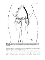 A History of Vascular Surgery - part 8 ppsx