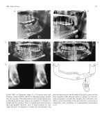 Craniomaxillofacial Reconstructive and Corrective Bone Surgery - part 4 ppt