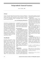 Gãy xương đùi ppsx